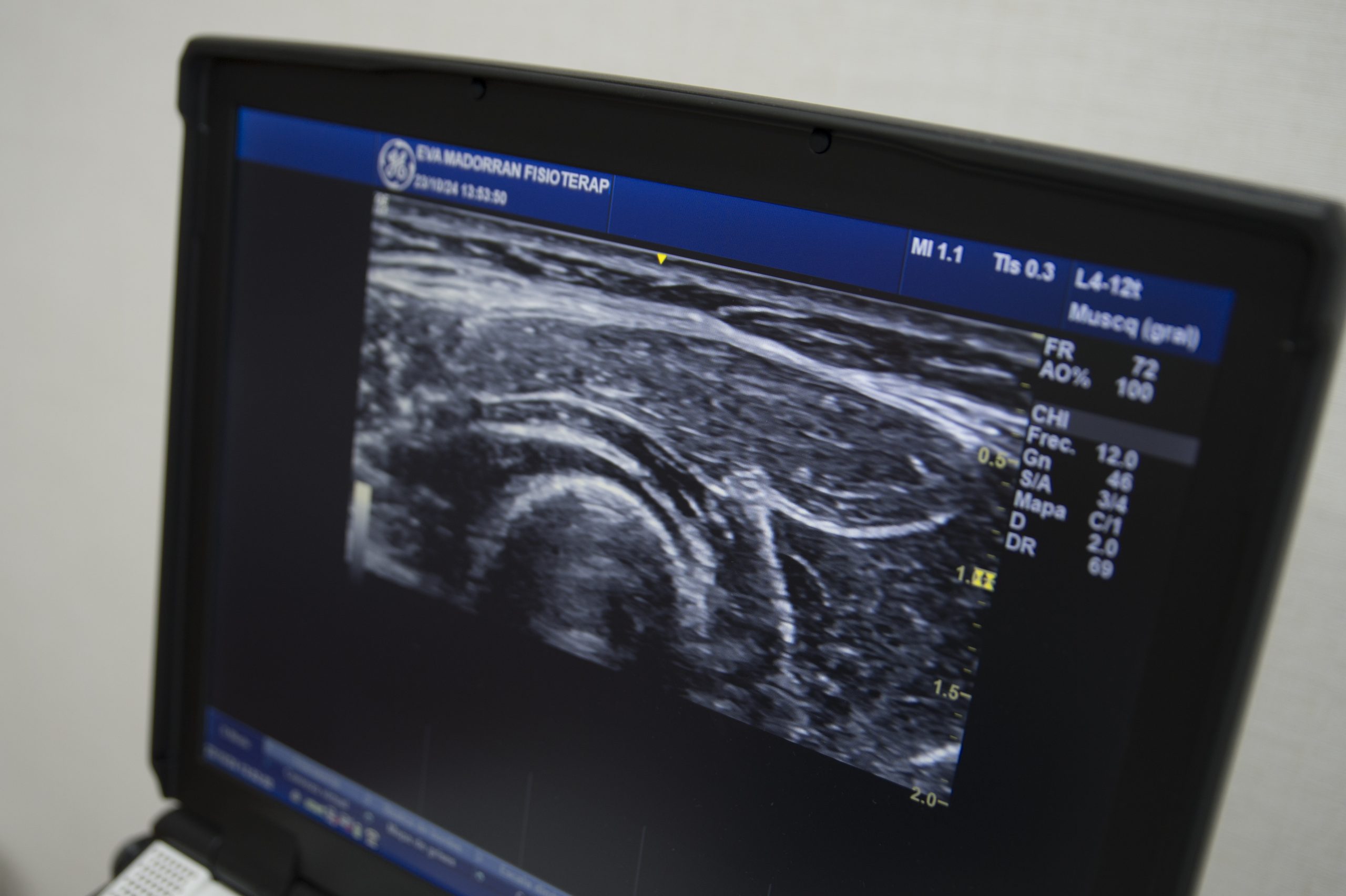 Ecografía musculoesquelética